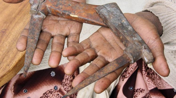 Mit diesem rostigen Werkzeug haben ehemalige Beschneiderinnen in Äthiopen die Genitalien von Frauen verstümmelt.