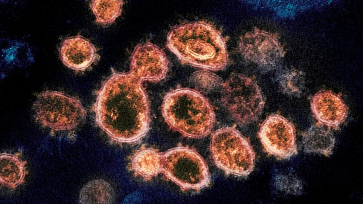 Das Coronavirus unter dem Mikroskop. Das Coronavirus unter dem Mikroskop.