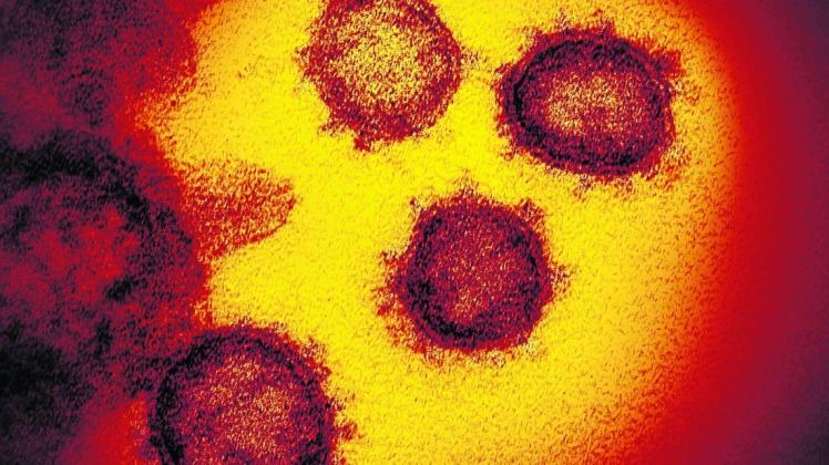 Das Coronavirus unter dem Mikroskop. Das Coronavirus unter dem Mikroskop.