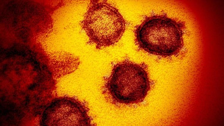Trotz einer Größe von 60 bis 140 Nanometern hat das Coronavirus die ganze Welt lahmgelegt.