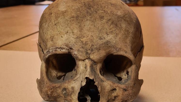 Einer der 15 historischen Schädel, die jetzt auf die Reise geschickt wurden.