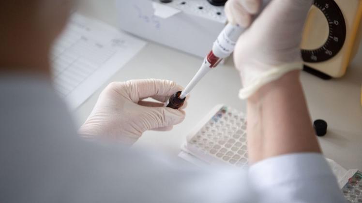 Eine Mitarbeiterin des Landesgesundheitsamts Baden-Württemberg testet Blutproben auf Antikörper. Das Landesgesundheitsamt ist fachliche Leitstelle für den Öffentlichen Gesundheitsdienst in Baden-Württemberg.