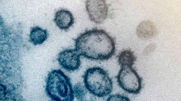 Zum Schutz vor einer Infizierung mit dem Coronavirus wurden in Meppen zwei Veranstaltungen verschoben. 