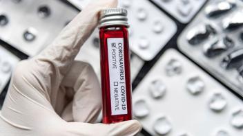 Welches Medikament könnte gegen Covid-19 helfen? Wissenschaftler forschen mit Hochdruck nach geeigneten Mitteln gegen die Erkrankung durch das Coronavirus. Foto: imago images/Future Image