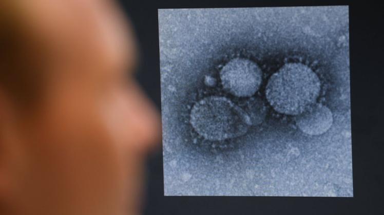Aufnahme eines MERS-Coronavirus, eines engen Verwandten des neuartigen Coronavirus. Das Coronavirus beschäftigt zahlreiche Wissenschaftler, die versuchen, einen Impfstoff zu entwickeln. Foto: Arne Dedert/dpa