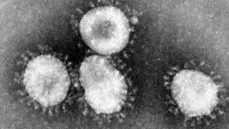 Das Coronavirus breitet sich rasend schnell aus. Diese Karte zeigt, wo es auf der Welt schon Covid-19-Fälle gibt. Foto: dpa/Center for Disease Control/epa