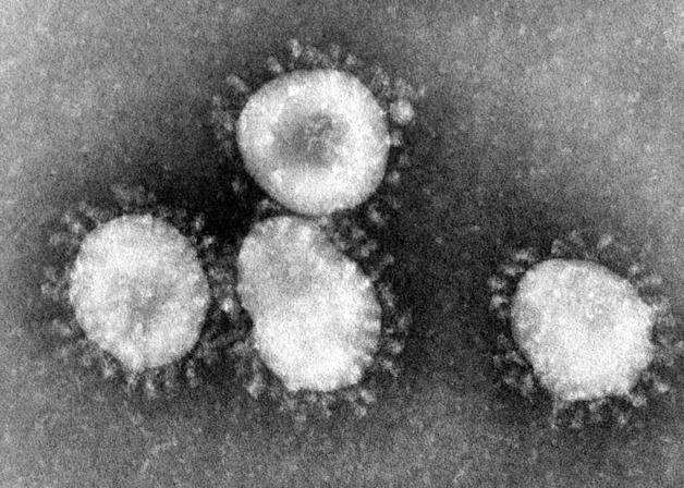 Dieses undatierte Handout des amerikanischen Centers for Disease Control (CDC) zeigt einen Coronavirus unter dem Mikroskop. Foto: dpa/Center for Disease Control