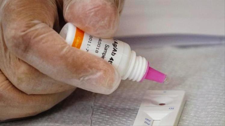 Ein Fachmann führt einen HIV-Test durch. Der Wissensstand zu HIV sei laut Experten seit vielen Jahren auf einem hohen Niveau. 