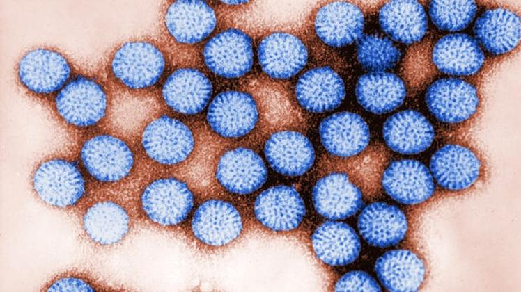 Der Rotavirus grassiert im Emsland. Foto: dpa/Bryon Skinner/CDC)