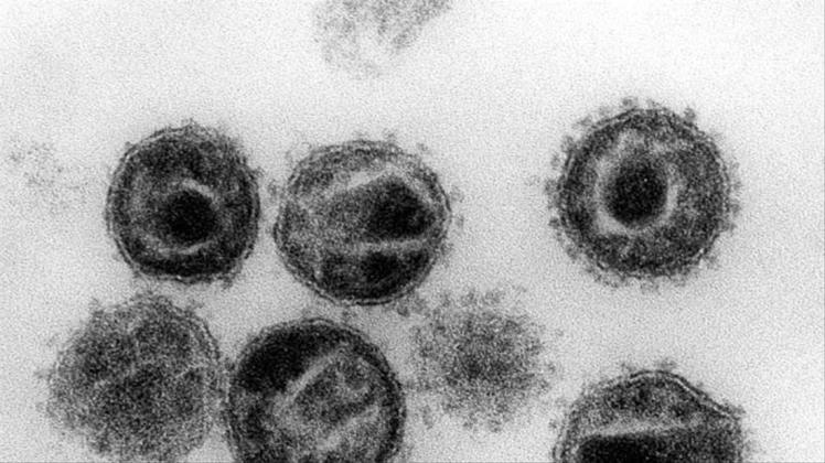 Das HI-Virus befällt und zerstört bestimmte Zellen der Immunabwehr und macht Infizierte anfällig für Krankheiten. 