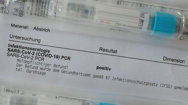 In der Stadt Neumünster wurden bis Montag, 1. November, um 12 Uhr insgesamt 2637 Fälle einer Covid-19-Infektion  mit Labornachweis bestätigt.