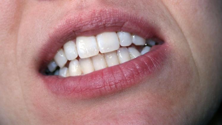 Schmerzhaft: Zähneknirschen zählt schon fast als Volkskrankheit. Symbolfoto