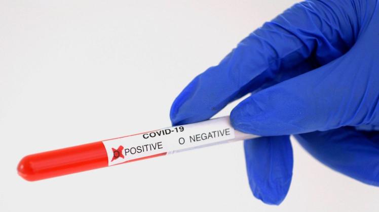 Nach einem positiven Corona-Test werden Infizierte im Landkreis Emsland nicht mehr persönlich vom Gesundheitsamt kontaktiert. Die Informationen werden per SMS, E-Mail und per Post verschickt.