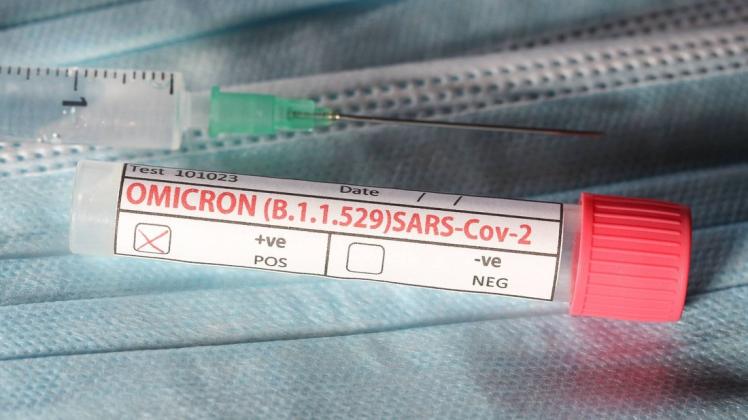 Bei einem Reiserückkehrer aus Südafrika ist in Niedersachsen die Omikron-Variante des Coronavirus nachgewiesen worden. Bei einem Reiserückkehrer aus Südafrika ist in Niedersachsen die Omikron-Variante des Coronavirus nachgewiesen worden.