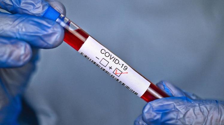 Angesichts der aktuell steigenden Zahl von COVID-19 infizierten Personen im Landkreis Emsland trifft die Gemeinde Geeste weitere präventive Regelungen.
