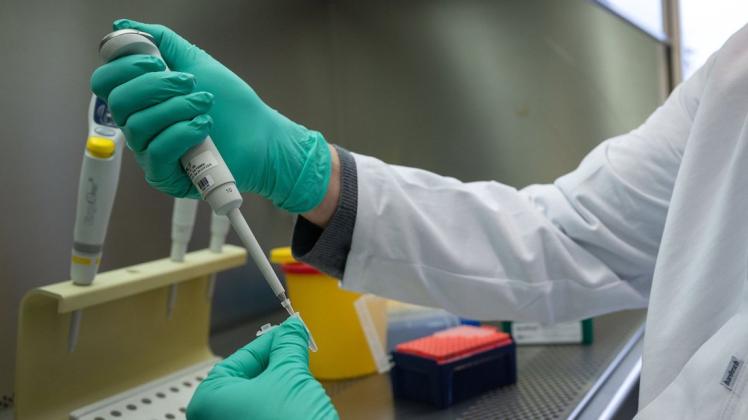 Ein Forscher zeigt, wie ein PCR-Test für die Analyse auf Mutationen des Coronavirus vorbereitet wird.