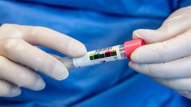 Der Kreis Steinfurt hat auf seiner Internetseite Corona-Teststellen aufgelistet, die PCR-Tests anbieten. (Symbolfoto)