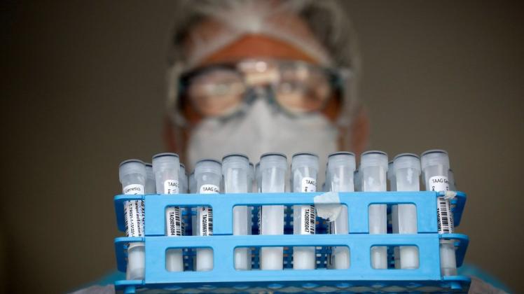 Mit steigenden Corona-Infektionszahlen wächst auch die Nachfrage nach PCR-Tests. Doch wer hat eigentlich einen Anspruch auf kostenfreie PCR-Tests und wo bekommt man diese in Stadt und Landkreis Osnabrück? (Symbolbild)