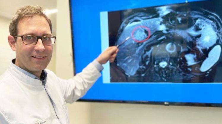 Philipp Kaudel, Chefarzt Allgemein-, Viszeral- und spezielle Viszeralchirurgie sowie Onkologische Chirurgie am Krankenhaus Meppen, zeigt eine Metastase in der Leber.