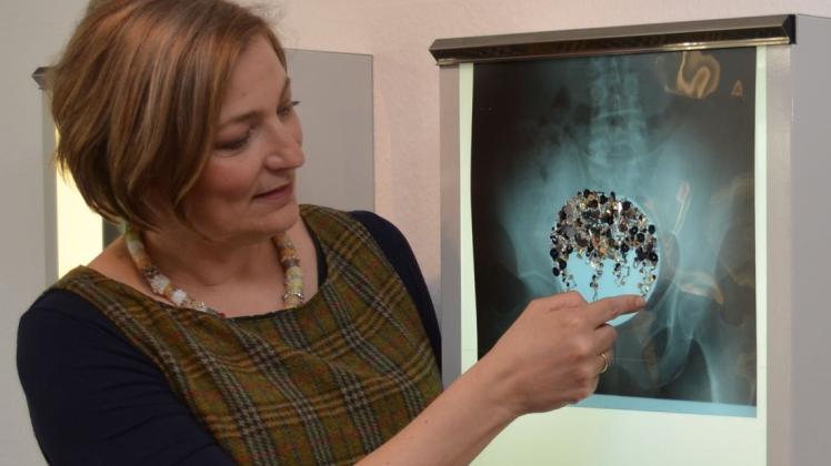 Originell und mal etwas anderes: Stephanie Ritterhoff hat alte Röntgenbilder umgearbeitet. 