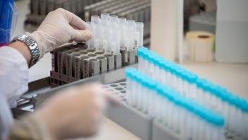 Da Omikron ansteckender als andere bekannte Varianten ist, wird weiterhin mit steigenden Infektionszahlen und zugleich mit steigendem Bedarf an PCR-Testungen gerechnet.