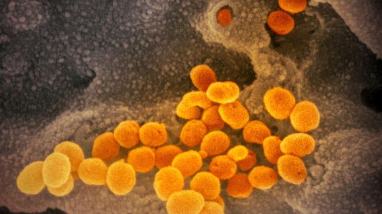 Forscher an der Frankfurter Goethe-Universität haben bei Experimenten mit Zellen, die von Sars-CoV-2 befallen sind, die Virusvermehrung mit Krebs-Medikamenten gestoppt.
