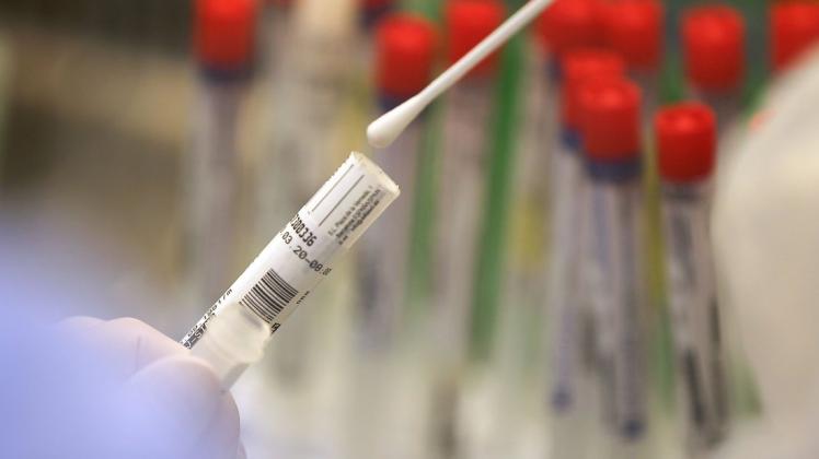 Die Zahl der Personen, die aktuell mit dem Coronavirus infiziert sind, ist am Freitag im Landkreis Cloppenburg auf 216 angestiegen – 29 mehr als noch am Donnerstag. Die Zahl der Personen, die aktuell mit dem Coronavirus infiziert sind, ist am Freitag im Landkreis Cloppenburg auf 216 angestiegen – 29 mehr als noch am Donnerstag.