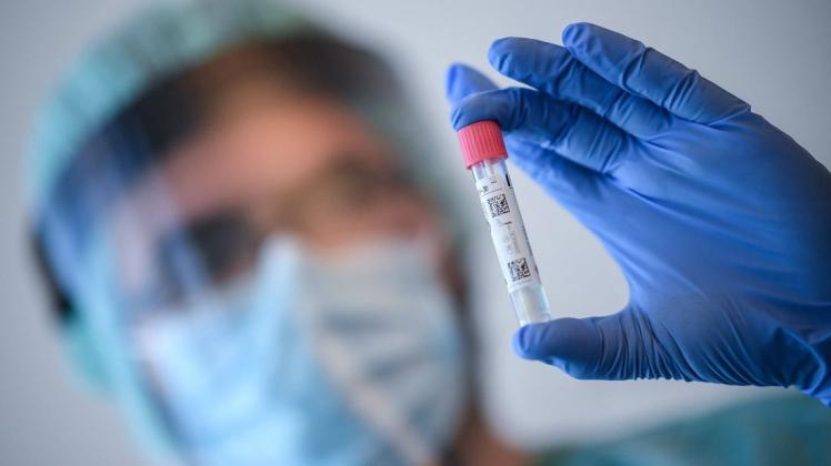 Wenn die Corona-App mit roter Farbe ein erhöhtes Infektionsrisiko signalisiert, kann ein Test auf SARS-CoV-2 sinnvoll sein. Wenn die Corona-App mit roter Farbe ein erhöhtes Infektionsrisiko signalisiert, kann ein Test auf SARS-CoV-2 sinnvoll sein.