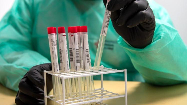 PCR-Tests bei kleinsten, bei Kindern fast schon normalen Symptomen? Das halten nicht alle Kinderärzte für sinnvoll.