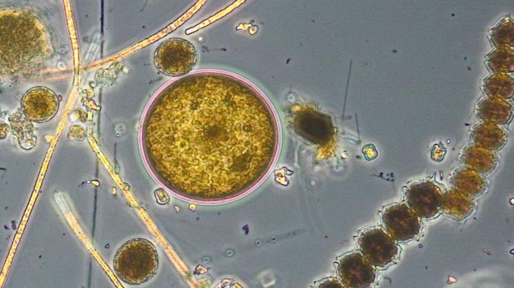Ein mikroskopische Aufnahme vom Phytoplankton.