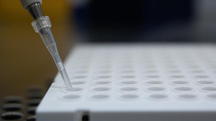 Baden-Württemberg, Stuttgart: Ein Forscher zeigt im Landesgesundheitsamt Baden-Württemberg, wie ein PCR-Test für die Analyse auf Mutationen des Coronavirus vorbereitet wird. Foto: Sebastian Gollnow/dpa