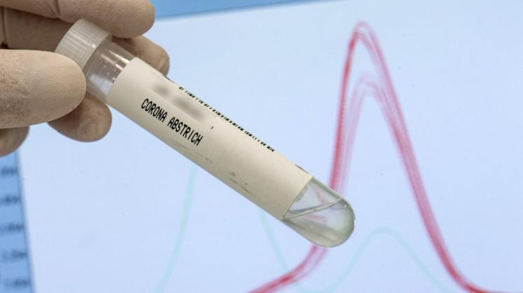 Die als besonders ansteckend geltende Delta-Mutation hat mittlerweile einen dominanten Anteil unter den Corona-Neuinfektionen in Deutschland erreicht. Die als besonders ansteckend geltende Delta-Mutation hat mittlerweile einen dominanten Anteil unter den Corona-Neuinfektionen in Deutschland erreicht.