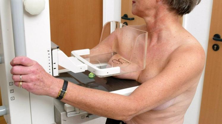 Bei der Mammografie kann Brustkrebs in einem frühen Stadium erkannt werden.