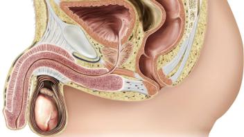 Schwachpunkt Vorsteherdrüse: Das Prostatakarzinom ist in Deutschland die häufigste Krebserkrankung bei Männern. Auf unserer Grafik ist die Prostata das herzförmig dargestellte Organ genau in der Mitte, zwischen Blase und Schwellkörpern.