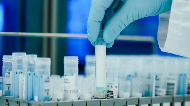 PCR-Test