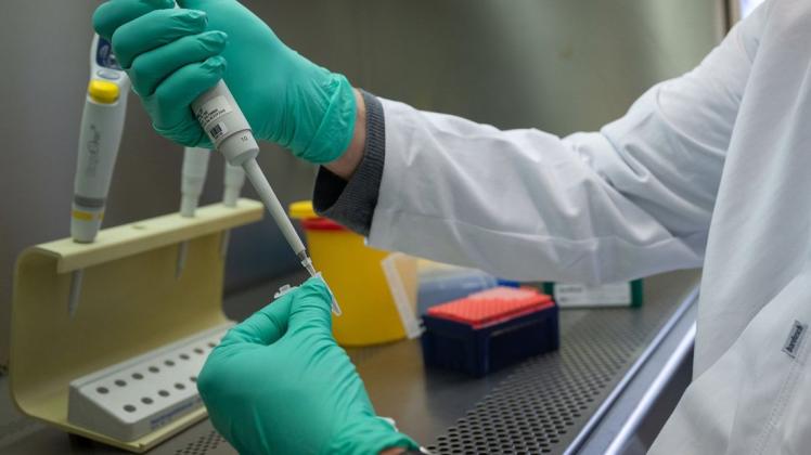 Ein Forscher zeigt, wie ein PCR-Test für die Analyse auf Mutationen des Coronavirus vorbereitet wird.       (zu