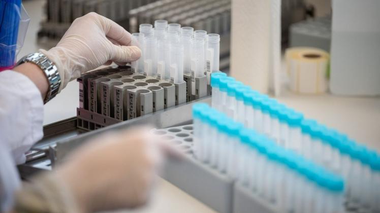 Nach PCR-Tests sind in Südtondern aktuell fast 600 Menschen mit dem Coronavirus infiziert.