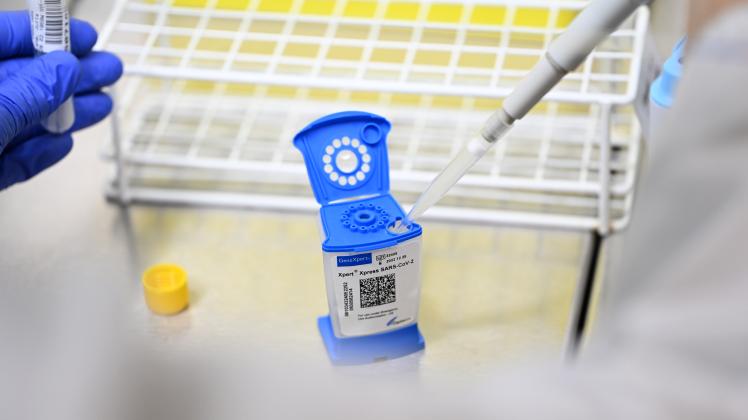 Jetzt werden PCR Testlabore massenweise gebraucht –aber wie lange noch?