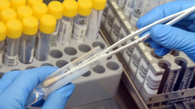 Die Labore sind laut Lauterbach fähig, mit noch mehr PCR-Tests umzugehen. (Symbolbild)