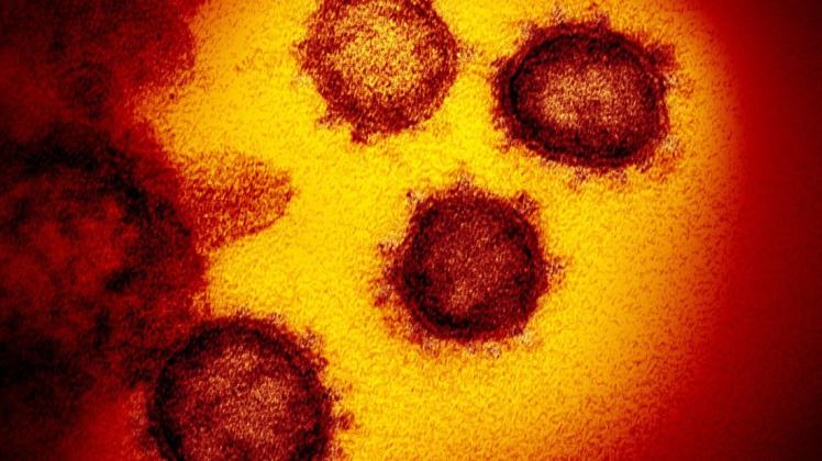 Eine Elektronenmikroskopaufnahme zeigt das Coronavirus SARS-CoV-2. Forscher gehen davon aus, dass sich das Coronavirus weiter verändern wird.