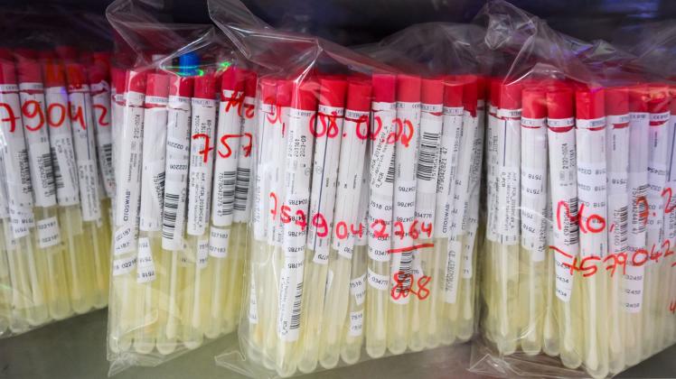 PCR-Test Auswertung im Labor