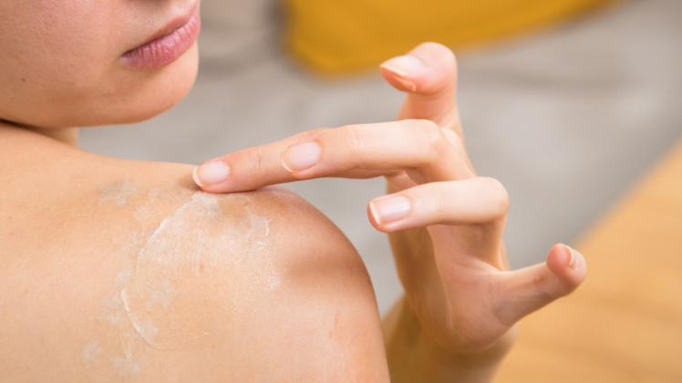 Eine Frau versorgt ihre Haut mit einer Creme