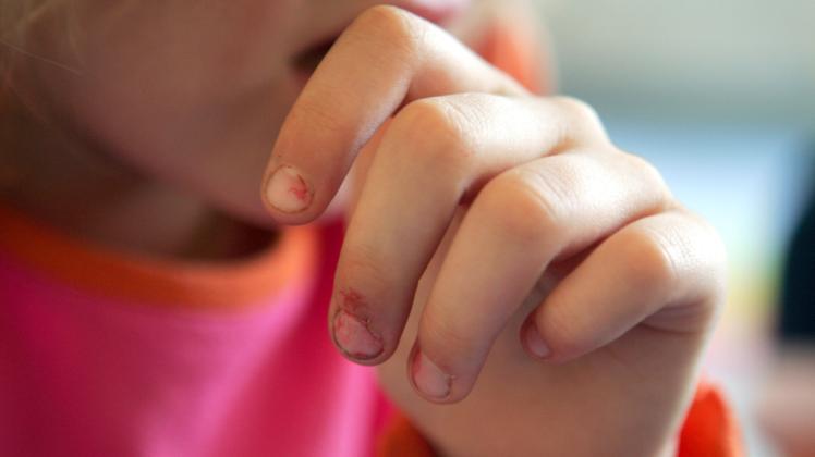 Ein 42-Jährigen aus schwerin wird sexueller Missbrauch von Kindern und Jugendlichen in 62 Fällen vorgeworfen.