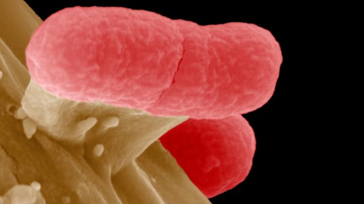 Ehec-Bakterien, eine gefährlichen Variante des harmlosen Darmbewohners Escherichia coli, unterm Elektronenmikroskop  