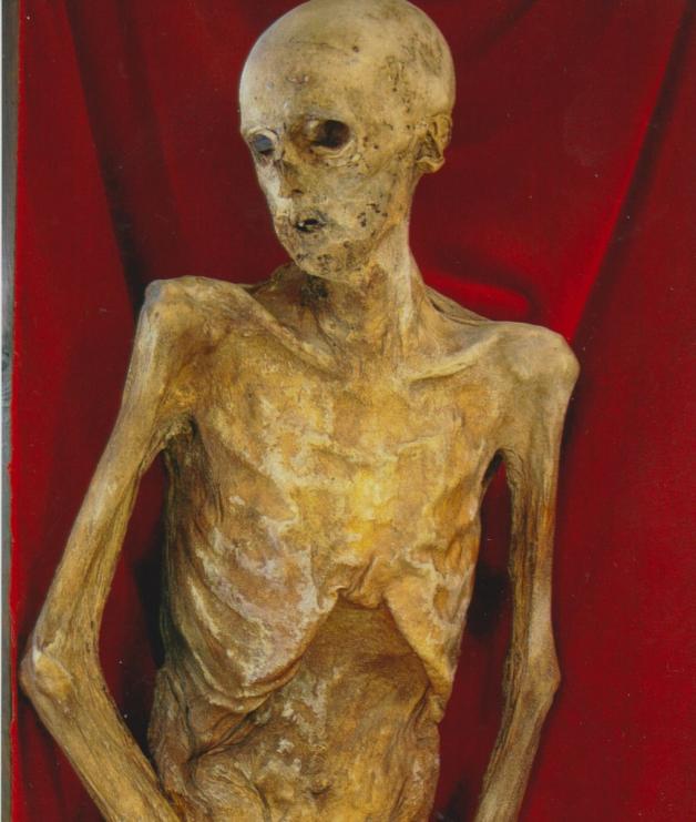 Die Mumie wird in Potsdam aufbewahrt.  