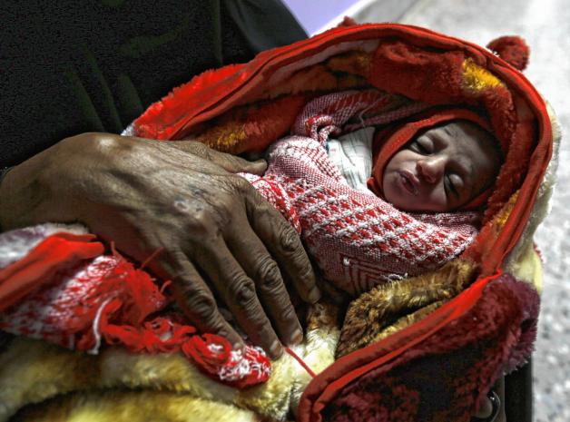 Die Schwächsten trifft die Not am härtesten: Ein mangelernährtes Baby in Sanaa.