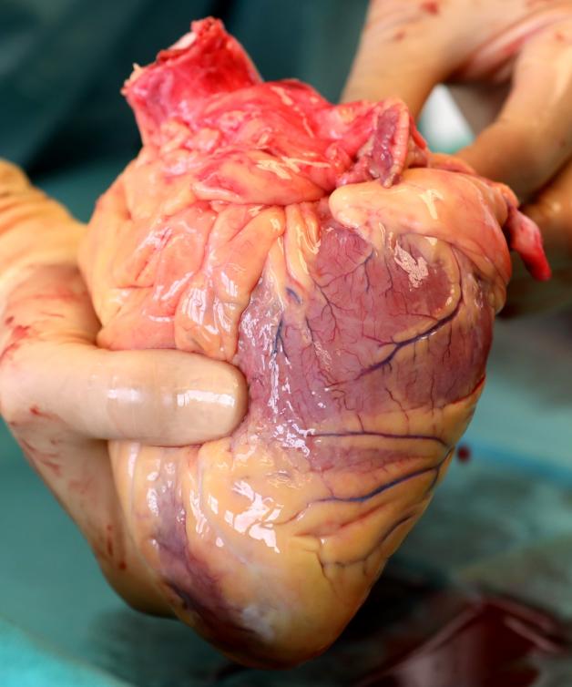 Das Herz eines Verstorbenen, das kurz zuvor entnommen wurde. Von ihm werden Herzklappen für Gewebespenden verwendet. 