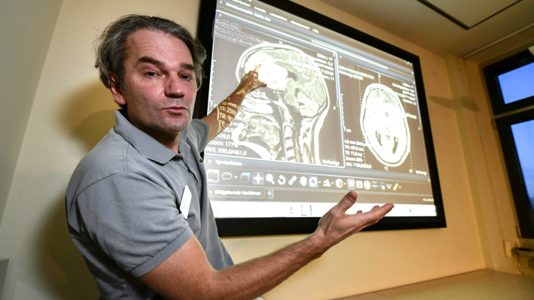 Digitale Patientenakte auf dem Bildschirm und maßgeschneiderte Therapie: Dr. Oliver Heese, Leiter des Neuroonkologischen Zentrums zur Behandlung von Hirntumoren, spricht mit Experten der Fachkliniken die geeignete Behandlung für den Patienten ab.