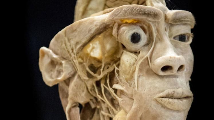 Am Sonntag sind plastinierte Körper zu sehen. 
