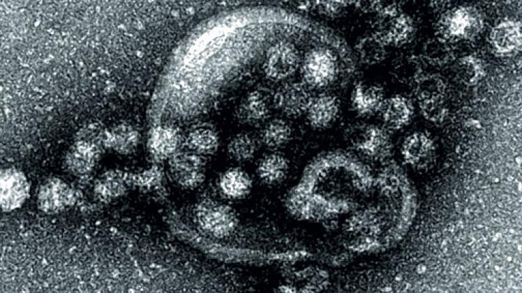 Das Norovirus  wurde erstmals 1972 mikroskopisch erkannt und beschrieben. Foto: dpa